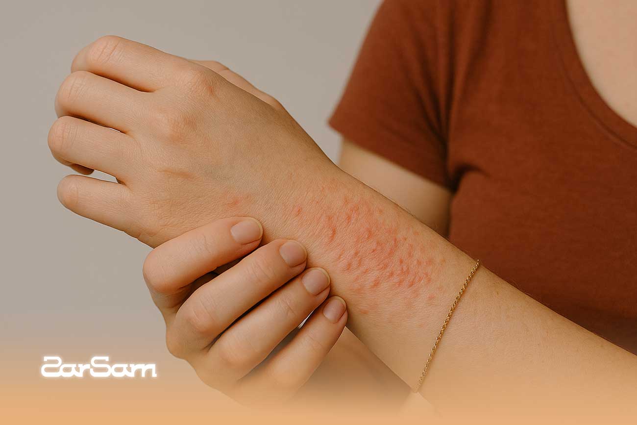 علائم حساسیت به طلا و درمان آن علت نشانه و راهکار سریع - زرسام